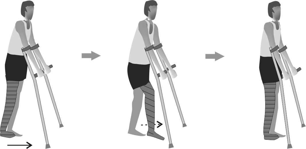 tib fib fracture rehab protocol