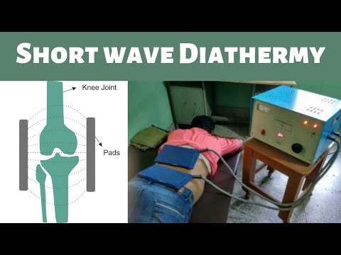 Diathermy: Electrode placement, indication, contraindication of SWD