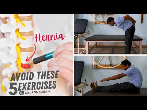 5 Exercises to Avoid with Bulging Disc (Sciatica/ Disc hernia) in Lower Back