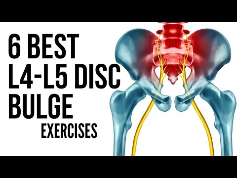 6 Best L4 L5 Disc Bulge Exercises in Hindi to avoid surgery