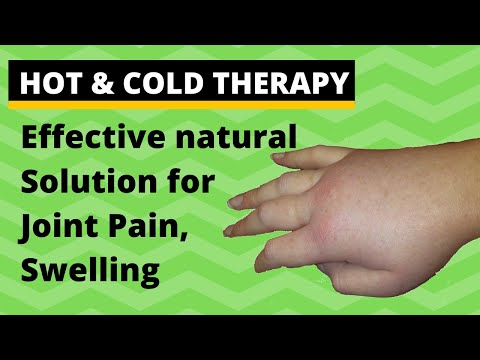 Hot and Cold Therapy for Joint Pain &amp; Swelling (Hindi)