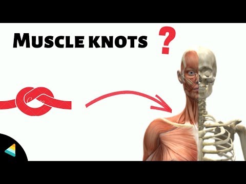 Muscle Knots Explained | Why do we get muscle knots