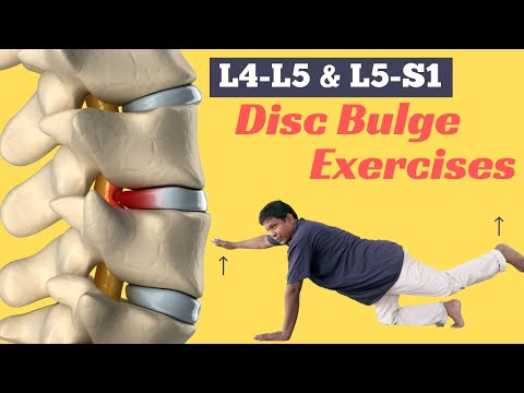 6 Best Diffuse Disc Bulge at L4-L5 and L5-S1 Treatment Exercises