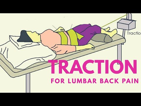 Traction for low back pain.