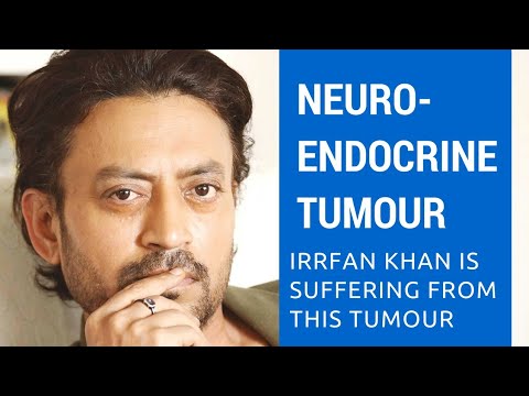 Everything about Neuroendocrine Tumour.:A rare disease Irrfan Khan is suffering from.