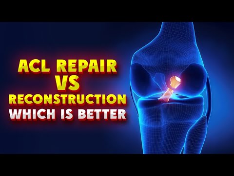 Is ACL repair same as reconstruction? ACL Repair Vs Reconstruction