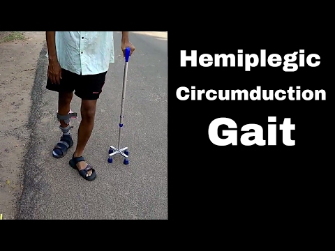 How does a Hemiplegic Walks in Circumduction Gait