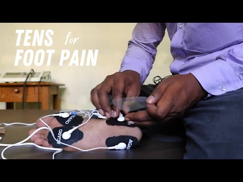 How to Use TENS Unit for Plantar Fasciitis Foot Pain