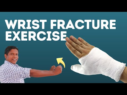 5 Effective Exercises for Wrist Fractures to Recover Faster