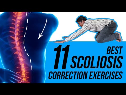 11 Easy Scoliosis Posture Correction Exercises