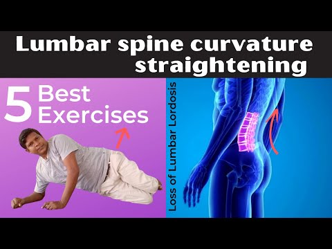 5 Best Loss of Lumbar Lordosis Correction Exercises| Lumbar spine curvature exercise