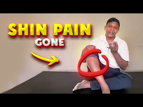 4 Easy Shin Pain Stretching Exercises| दौड़ने के बाद पैर में दर्द हो तो क्या करें?