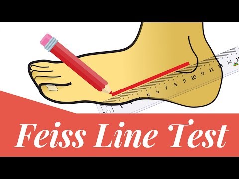 Feiss line test: How to measure flat foot?