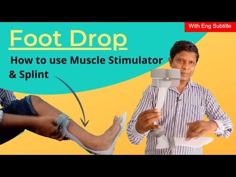 Splints for Foot Drop (AFO brace), Electrical Stimulation guide in Hindi