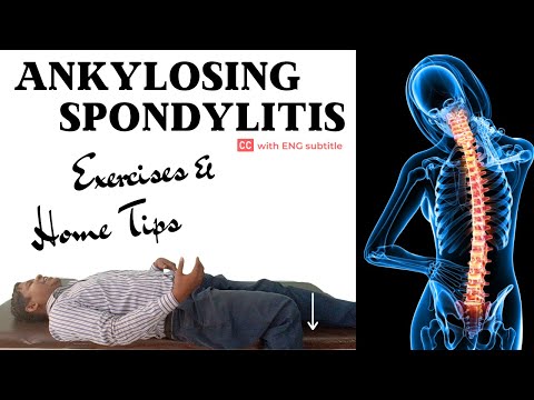 7 Best Ankylosing Spondylitis Exercises to prevent joint stiffness &amp; muscle tightness