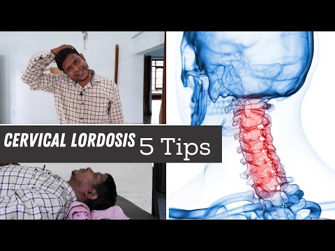 5 Best Loss of Cervical Lordosis Exercises &amp; Home Tips for Neck Pain