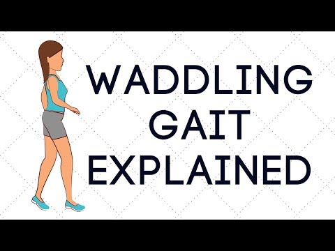 Waddling Gait Explained.