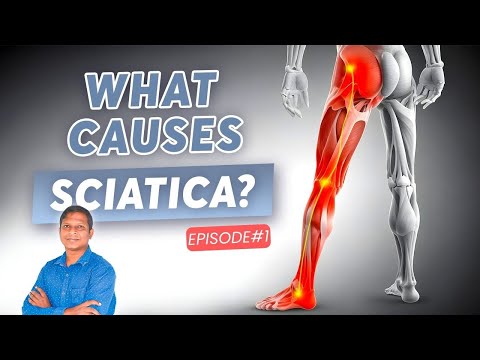 ये 3 कारणों से कमर का नस दब सकती है। What Causes Sciatica Pain in Left Leg? (Episode# 1)