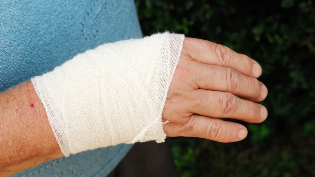 hand blast injury physiotherapy rehabilitation exercises