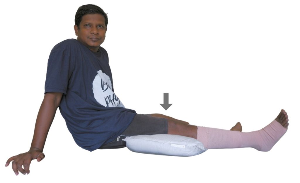 tibial shaft fracture physical therapy protocol