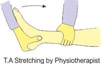 insertional achilles tendonitis stretching