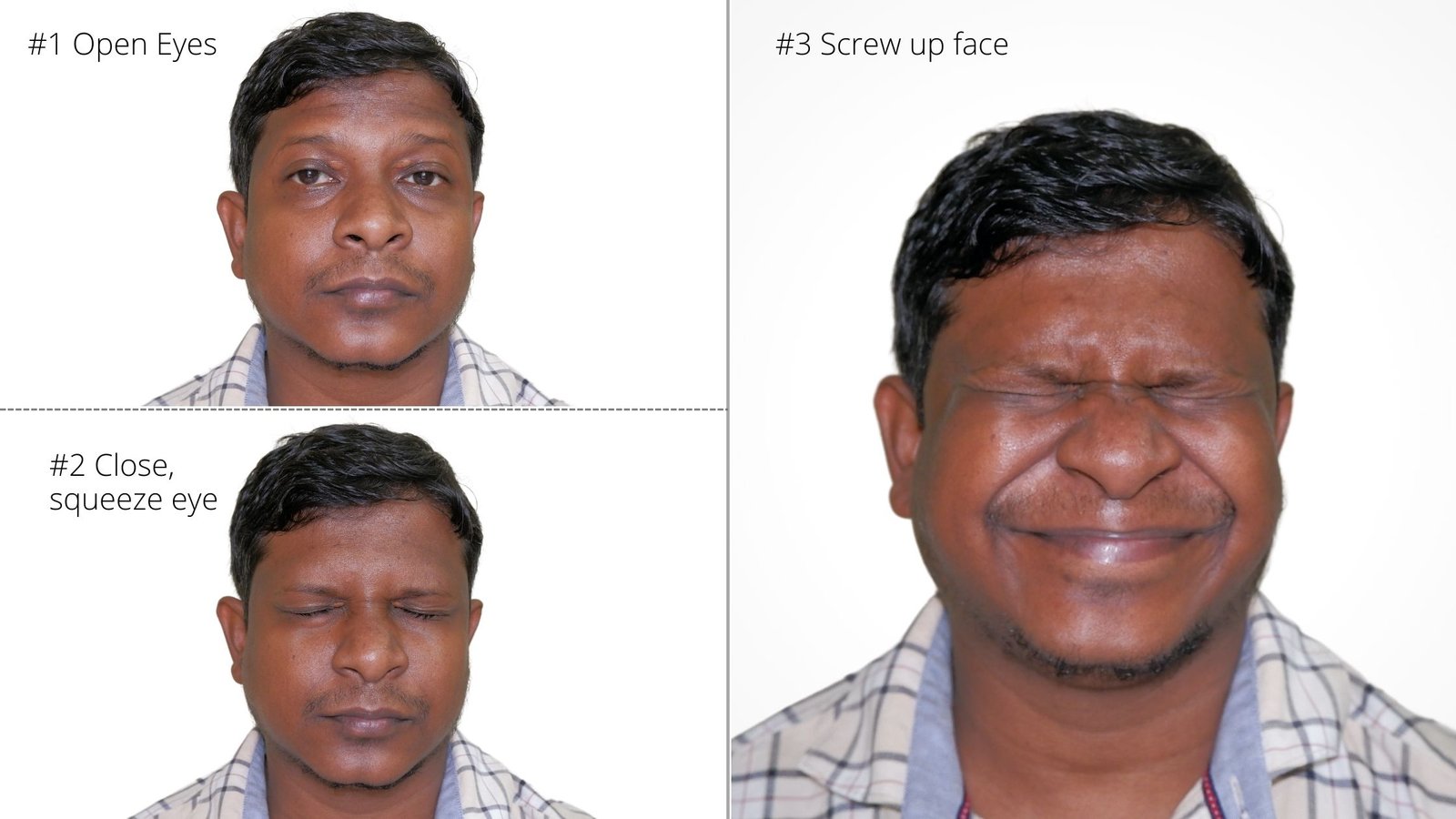 11 Easy Bell’s Palsy Exercises for Facial Weakness - PHYSIOSUNIT