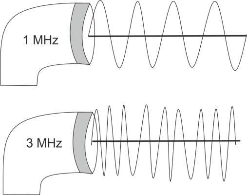 1mhz vs 3mhz ultrasound