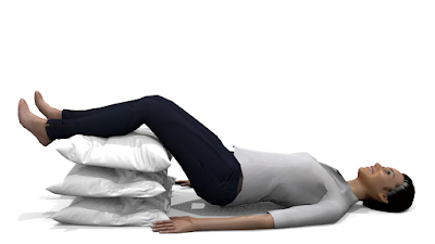 sleeping position for sciatica nerve pain
