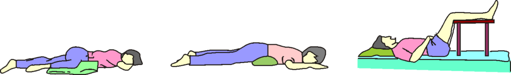 physical therapy for sciatica: sciatica sleeping position