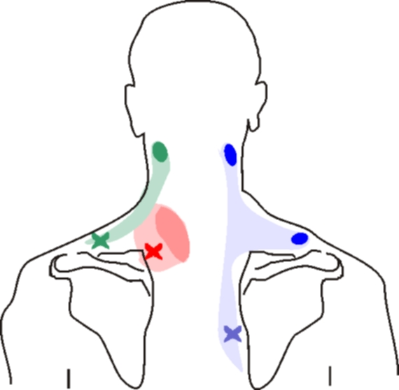 neck-pain-left-side-physiosunit