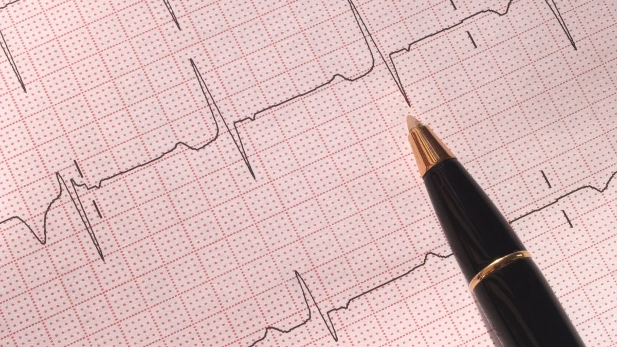 how to read ecg step by step