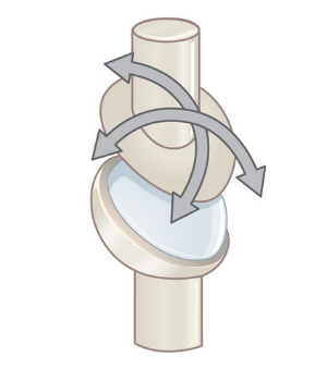 condylar joint