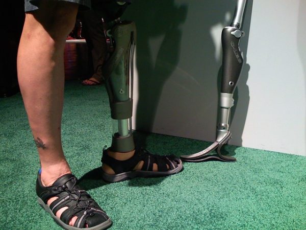 New 3D Tech prosthetic liners help more amputees walk again