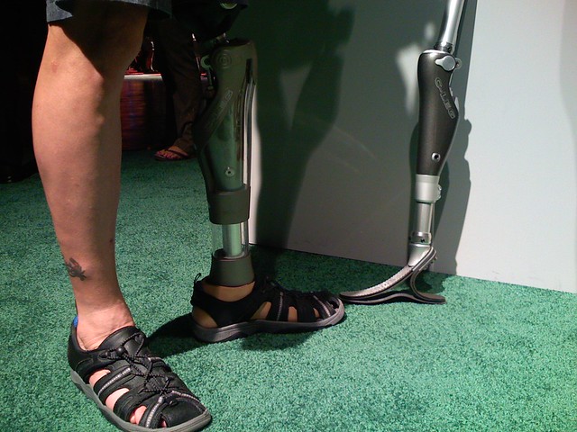 Tailor made prosthetic liners could help more amputees walk again
