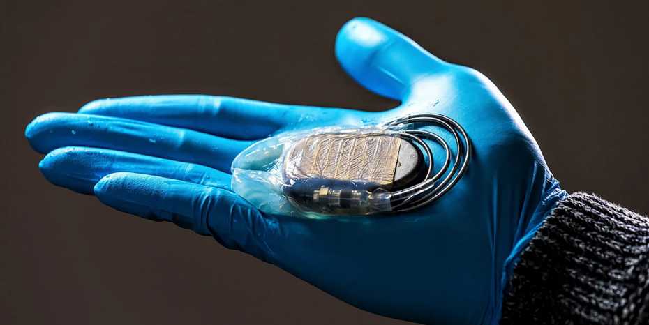 Protective membrane for pacemaker can simplify revision surgery