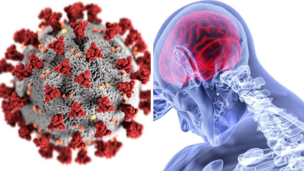 Coronavirus Increases Risk of Brain stroke, Early Signs you must watch for