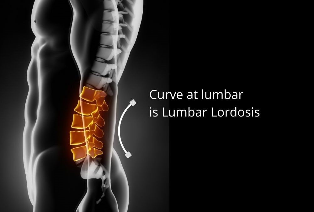 lumbar lordosis