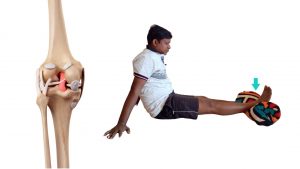 Knee Ligament Injury Treatment Exercise