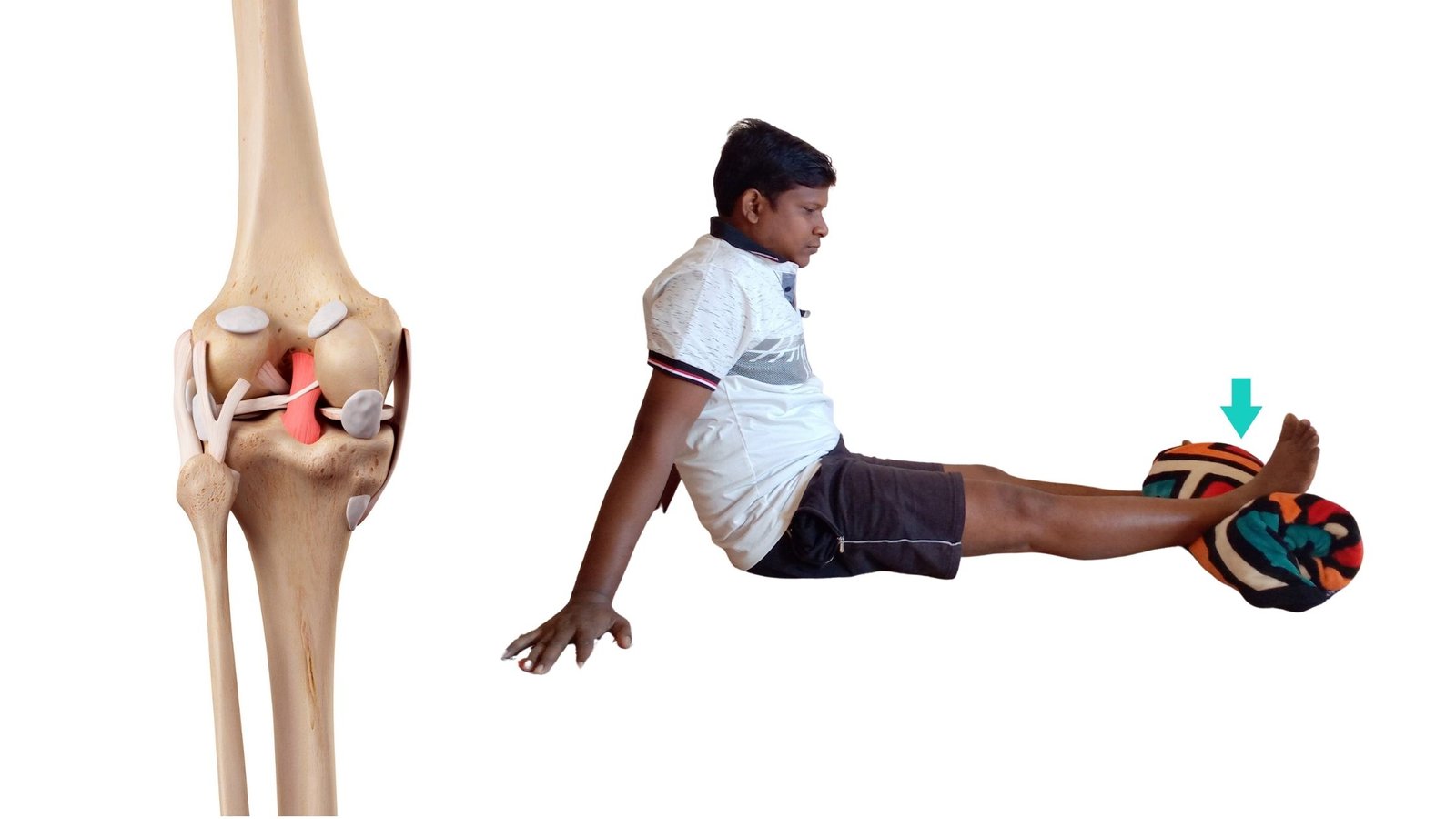 knee-ligament-strengthening