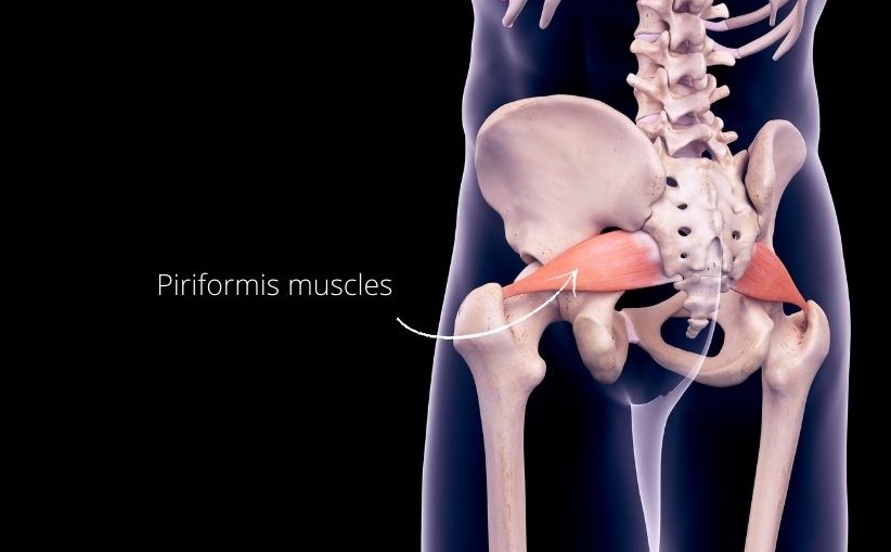 piriformis muscle syndrome