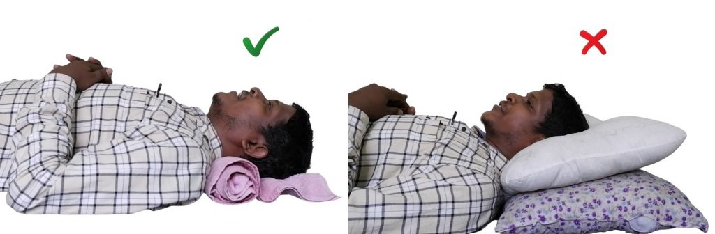 best sleeping position for lordosis