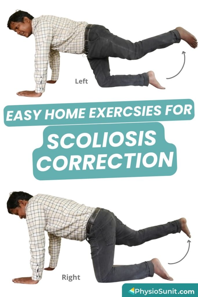 easy home exercises for scoliosis correction