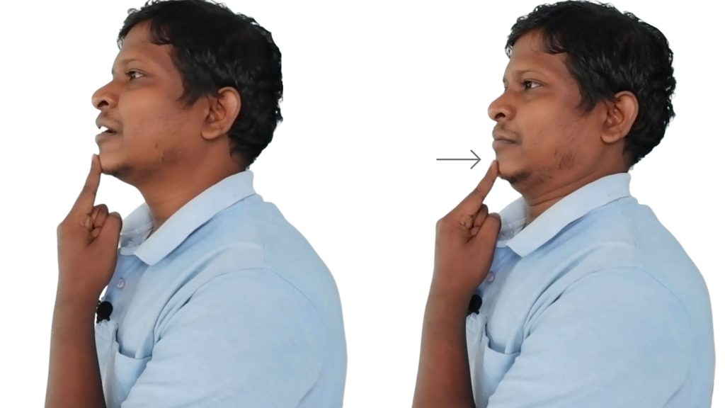 Chin tuck exercises for cervical disc bulge