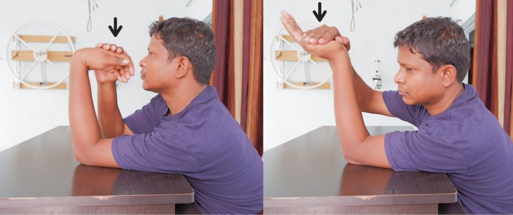 wrist stretching for post-operative elbow supracondylar fracture