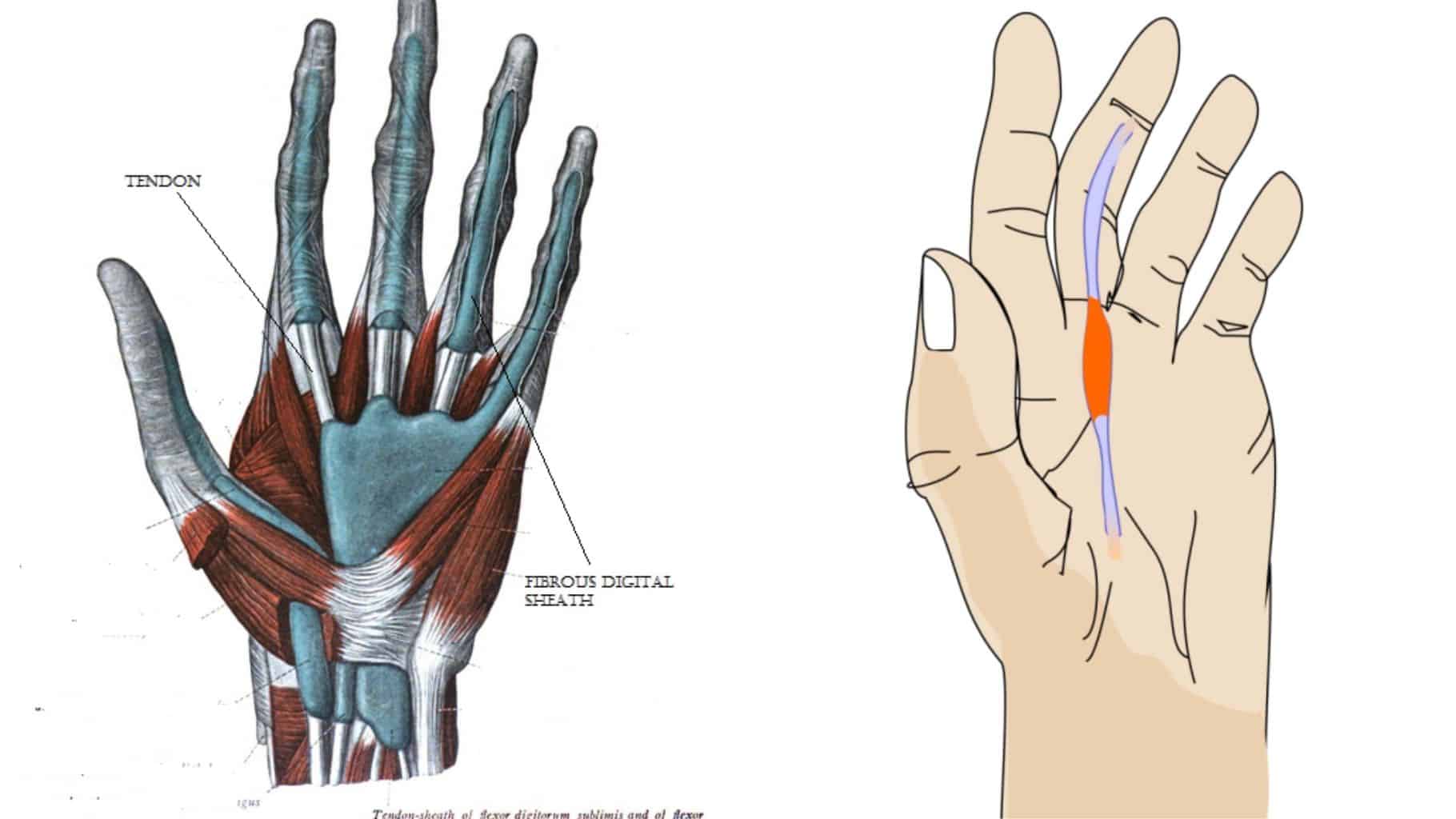 5 Easy Trigger Finger Exercises & Self-Massage Technique