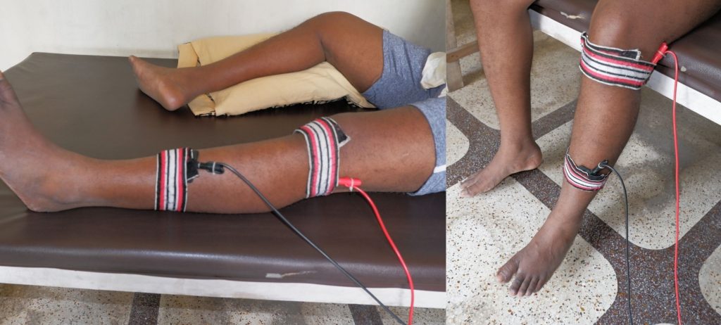 electrode placement for foot drop