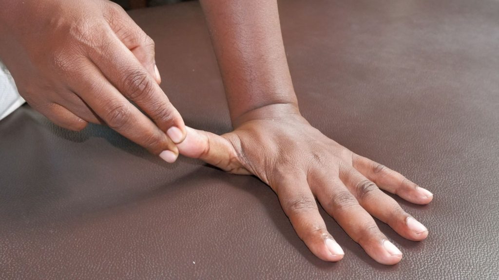 stretching exercises trigger thumb