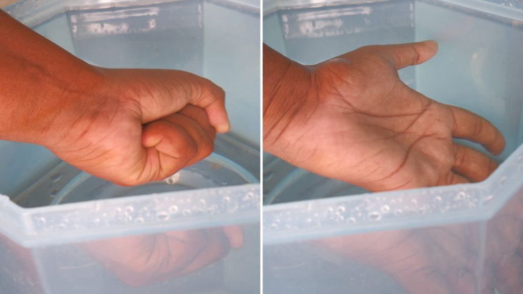 treatment for trigger finger in thumb