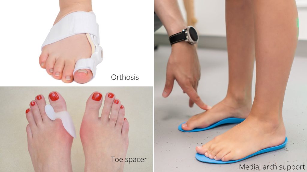 bunion splint