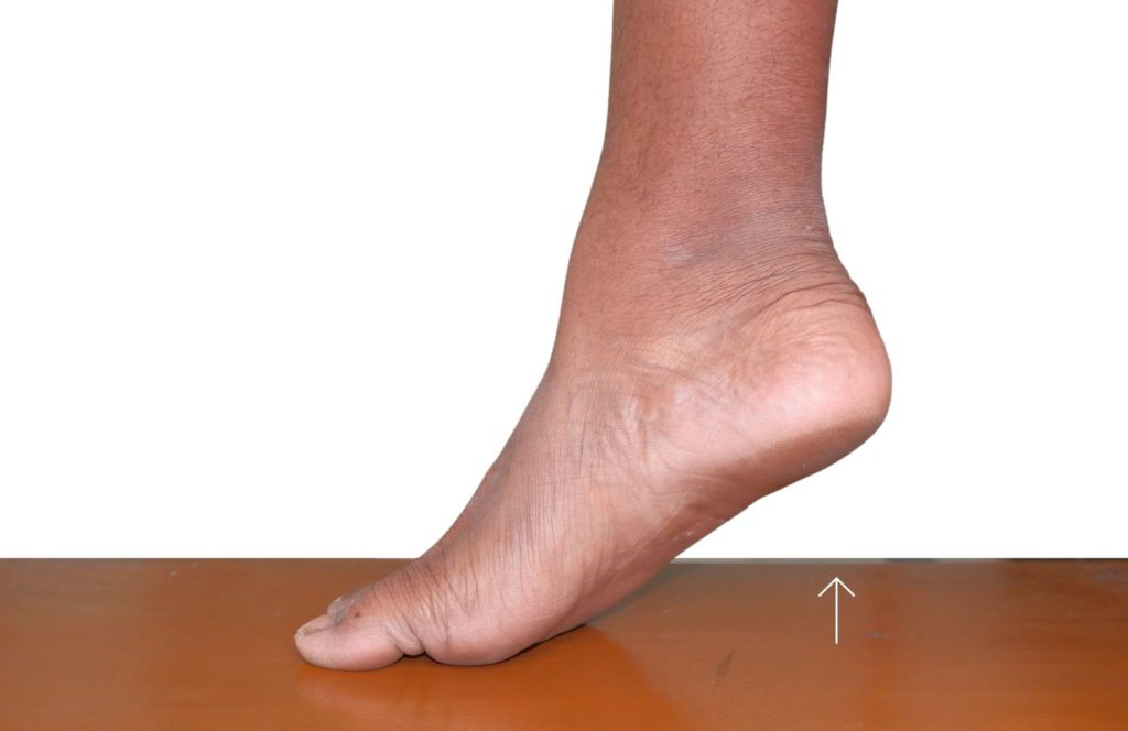 Heel off foot bunion exercises